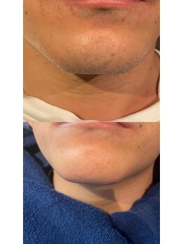 メンズサロン エイチ(H)/