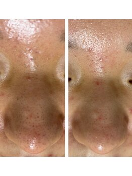 ハナ トータル ケア(Hana Total Care)/ダイヤモンドビリング