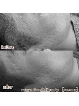 レヴール(reveur)/フェイシャルケアで美肌づくり