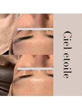 シエルエトワレ/CIVASAN シルク肌コース