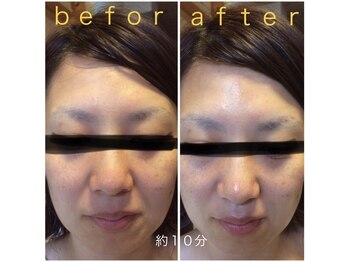 カイロプラクティック ネクサス/顔の歪み撃退☆