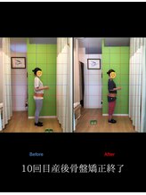 北てんま整骨鍼灸院/産後骨盤矯正１０回終了時の様子