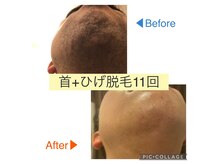 ローズマリー(rosemary)の雰囲気（効果絶大の脱毛！全身、VIO、部分脱毛、ひげ脱毛◎都度払いOK！）