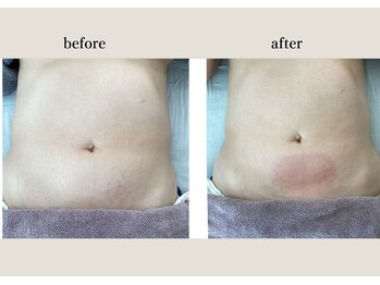 アンドスロウ(&slow)/ゆるかっさ