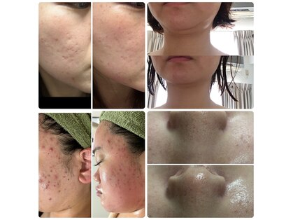 リクラ 北千住(Reclat)の写真