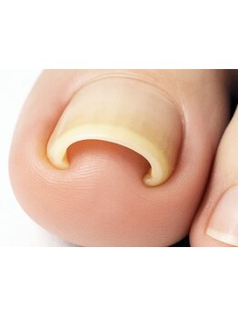 爪の悩みを解消できる（ケア含む）