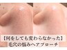 【5月の毛穴・日焼け対策】美容液で洗う毛穴洗浄 9,900円→7,900円 70分