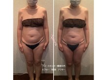 ナチュール(NaTuRu)/ビフォーアフター★5回目/50代