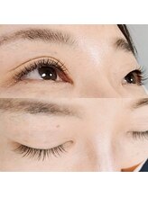 アンスリウム(Anthurium)/《フラットラッシュ》