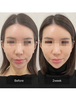 ラ クレール ビューティーサロン(LA CLAIR)/小顔リフトマシン豊富に取り揃え