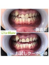 ルブラン 奈良店(Le Blanc)/一生モノのパートナー
