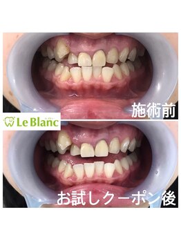 ルブラン 奈良店(Le Blanc)/一生モノのパートナー