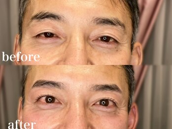 アイブロウアンドアイラッシュ ココ(COCO)/大人男性にも眉＋まつげパーマ！