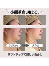 サロンフロム つくば店(Salon From)/◆コルギフェイシャル◆