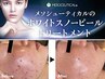 一日１名限定!!【瞬間☆白雪肌】肌トラブルと真剣に向き合うお客様へ22,000→