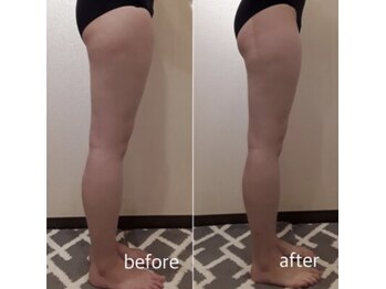 クリニカルエステ/イーズ 六甲アイランド店/【レモンボトル】下半身太り解消