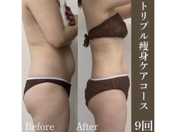 サロンドペシェ(salon de peche)/トリプル痩身ケアコース9回