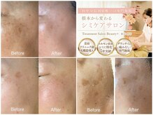 トリートメントサロンビューティープラス(Treatment Salon Beauty+)