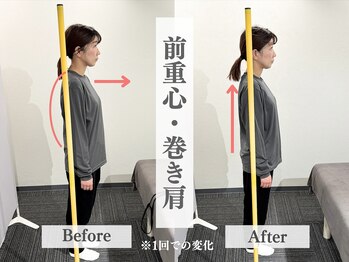 アライメントトウキョウ 恵比寿(Alignment TOKYO)/前重心・巻き肩改善