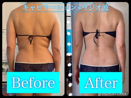 セリーヌ(serene)の写真