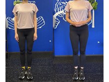 バブル(Bubble)/美尻コース60分12回