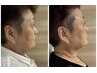限定4名様【脱老い】たるみ・美肌小顔プログラムで褒められ肌へ♪44,000→