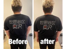 トトノウ 南口店(totonou)/Before after (25)