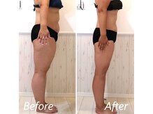 ドクターボディ 新宿店(Dr.Body)/全身しっかりダイエット☆