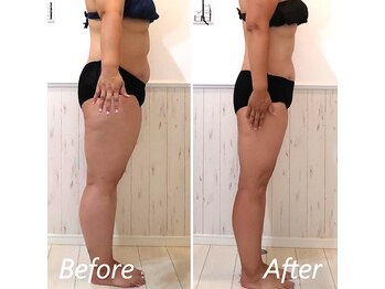 ドクターボディ 新宿店(Dr.Body)/全身しっかりダイエット☆