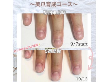 モナールアンド(MONNAL&)/5週間でこんなに！？