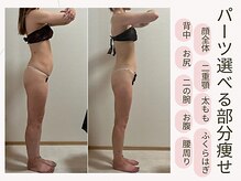 エイム(Aim)の雰囲気（痩身/フェイシャル/バストケア/ヘッドスパとコースが豊富◎）