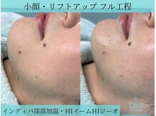 リメイク 広尾(REMAKE)/