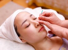 まゆ鍼灸院 岸和田 和泉/独自の美容鍼灸