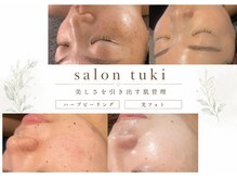 サロンツキ(salon tuki)