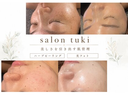 サロンツキ(salon tuki)の写真