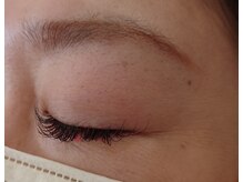 スマイル(Smile)/フラットラッシュ付け放題