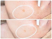 ベル(Bell)/お客様結果