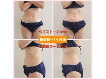 サロン ド エメ(Salon de Aimer)の雰囲気（人気の痩身！キャビ+ラジオ波+ハンドで、しっかり結果出します♪）