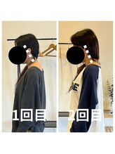 熊本カワル整体 JR上熊本駅院/2回目のお客様