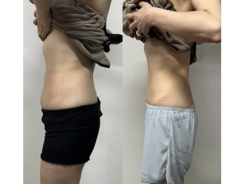 イイチェンジスタイル(iichangestyle)/全身エステの方の変化