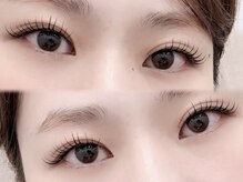 リートゥ(Riitoo)/アンドヘルシー/ブラック100本