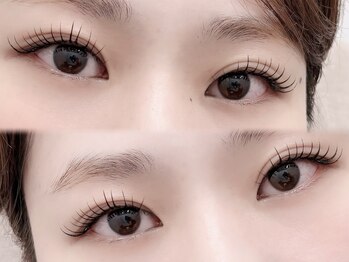 リートゥ(Riitoo)/アンドヘルシー/ブラック100本