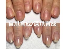 育成に特化した技術で健康な美爪へ…最短3ヶ月で結果を。