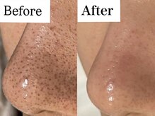 ウィズルーチェ 麻布十番店(with luce)