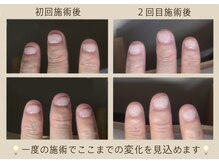 マッシュルーム グロウス(MUSHROOM GROWTH)