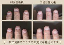 マッシュルーム グロウス(MUSHROOM GROWTH)