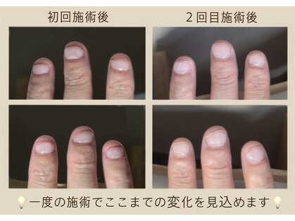 マッシュルーム グロウス(MUSHROOM GROWTH)の写真