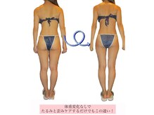 32歳女性/ナノカレントエステ全身