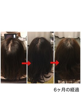 モモ 札幌(MOMO.)/育毛も叶う美髪へ