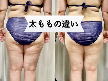 アンジュ(Ange)/太ももボコボコ減！！